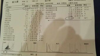 干咳不发烧男子被确诊罕见肺炎